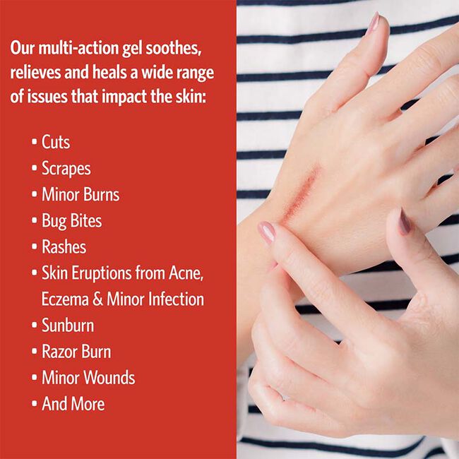 Sovereign Silver First Aid Gel image number null