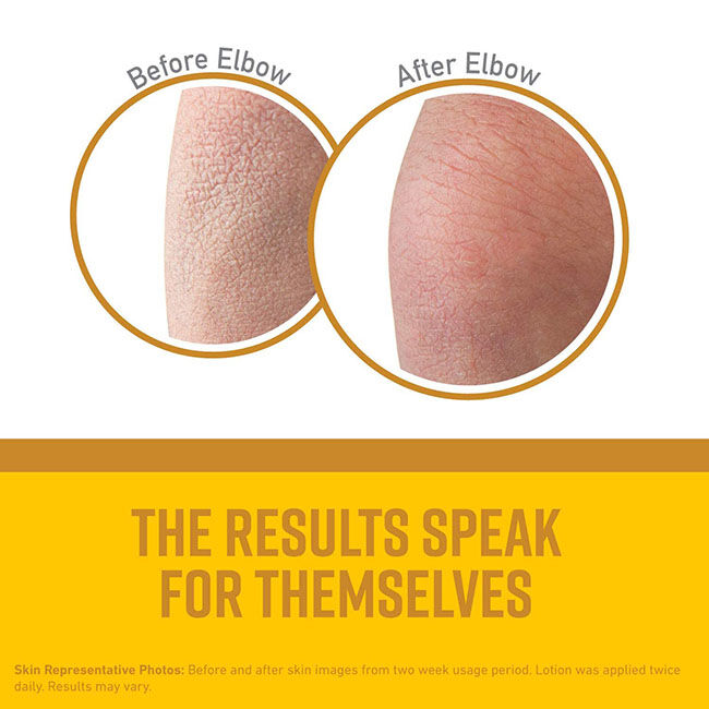 O'Keeffe's Skin Repair - Body Lotion for Extremely Dry, Itchy Skin - 7 oz image number null